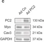 Fig.3.C showing Western Blotting in a Mus musculus (House mouse) sample from the publication: Polycystin-2 Is Required for Starvation- and Rapamycin-Induced Atrophy in Myotubes.
