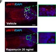 Fig.3.F showing Immunohistochemistry-immunofluorescence in a Homo sapiens (Human) sample from the publication: mTORC1 activity negatively regulates human hair follicle growth and pigmentation.