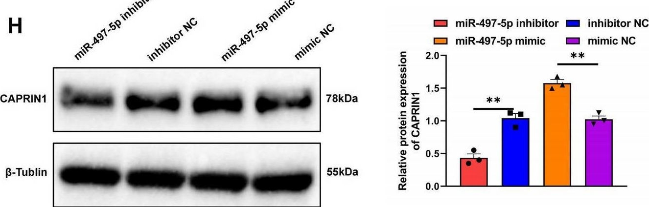Fig.6.H showing Western Blotting in a Homo sapiens (Human) sample from the publication: Targeting LINC02544/miR-497-5p/CAPRIN1 axis via exosome-based siRNA to overcome immunotherapy resistance in triple-negative breast cancer.