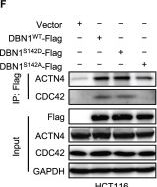 Fig.7.F showing Western Blotting from the publication: Integrative Omics Uncovers Low Tumorous Magnesium Content as A Driver Factor of Colorectal Cancer.