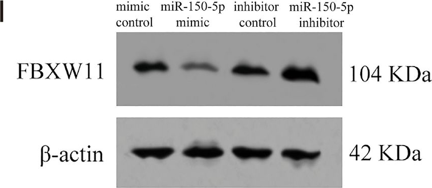 Fig.3.I showing Western Blotting in a Homo sapiens (Human) sample from the publication: Effective delivery of miR-150-5p with nucleus pulposus cell-specific nanoparticles attenuates intervertebral disc degeneration.