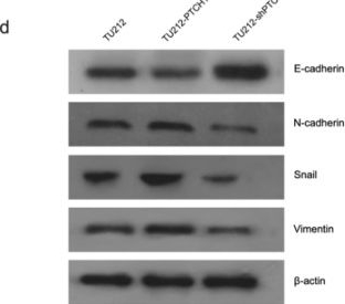 Fig.5.D showing Western Blotting in a Homo sapiens (Human) sample from the publication: Hsa-mir-1293/GLI1/PTCH1 axis is involved in proliferation, migration, and EMT of laryngeal cancer.