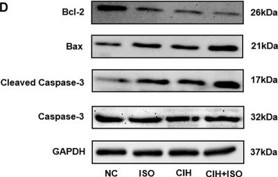 Fig.4.D showing Western Blotting in a Mus musculus (House mouse) sample from the publication: Chronic intermittent hypoxia exacerbates isoproterenol-induced cardiac hypertrophy and apoptosis.