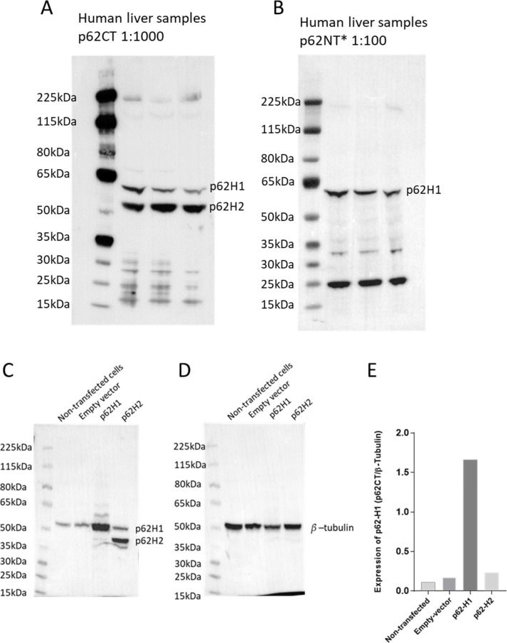 Different Roles of p62 (SQSTM1) Isoforms in Keratin-Related Protein Aggregation.