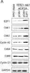 Fig.6.A showing Western Blotting from the publication: Cancerous inhibitor of protein phosphatase 2A contributes to human papillomavirus oncoprotein E7-induced cell proliferation via E2F1.