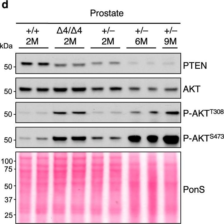 Fig.4.D showing Western Blotting in a Mus musculus (House mouse) sample from the publication: Hyperphosphorylated PTEN exerts oncogenic properties.