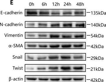Fig.2.E showing Western Blotting in a Homo sapiens (Human) sample from the publication: A Hidden "Promoter": Schistosoma japonicum soluble egg antigen activates MAPK/PI3K-AKT pathways and inhibits autophagy to facilitate colorectal cancer.