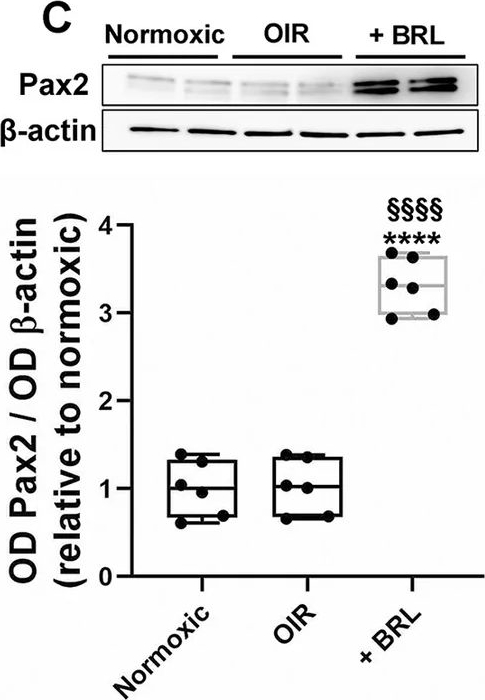 Fig.5.C showing Western Blotting from the publication: Novel insights into β3-adrenoceptor function in a model of retinopathy of prematurity: the contribution of astrocytes to retinal protection.