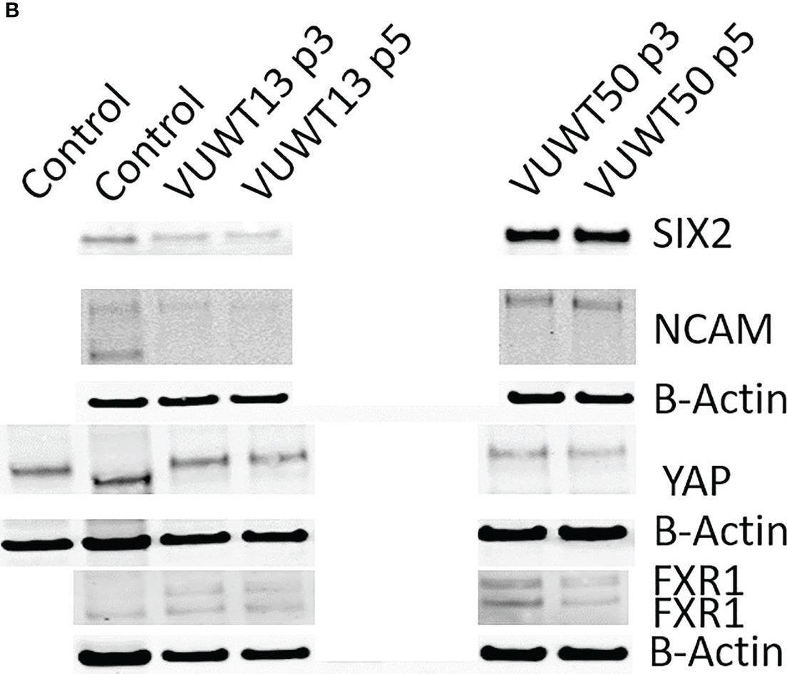 Fig.7.B showing Western Blotting from the publication: Exploiting embryonic niche conditions to grow Wilms tumor blastema in culture.