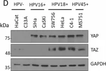 Fig.1.D showing Western Blotting in a Homo sapiens (Human) sample from the publication: The Hippo pathway transcription factors YAP and TAZ play HPV-type dependent roles in cervical cancer.