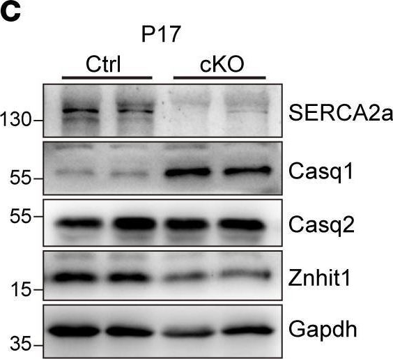 Fig.4.C showing Western Blotting from the publication: Critical role of Znhit1 for postnatal heart function and vacuolar cardiomyopathy.
