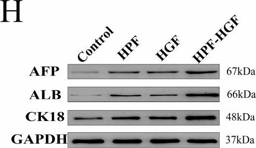 Fig.4.H showing Western Blotting from the publication: HPF Modulates the Differentiation of BMSCs into HLCs and Promotes the Recovery of Acute Liver Injury in Mice.