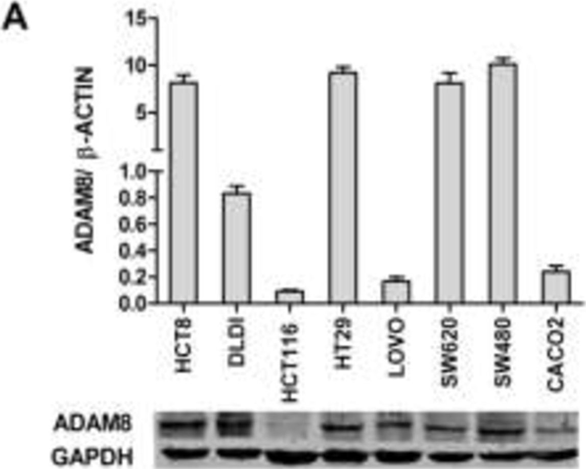 Fig.2.A showing Western Blotting in a Homo sapiens (Human) sample from the publication: Expression of A disintegrin and metalloprotease 8 is associated with cell growth and poor survival in colorectal cancer.