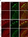 Fig.7.D showing Immunofluorescence in a Mus musculus (House mouse) sample from the publication: Staufen1 links RNA stress granules and autophagy in a model of neurodegeneration.