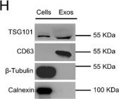 Fig.2.H showing Western Blotting from the publication: The exosomal miRNA/FOXN3 axis empowers fibroblasts with tumor-promoting functions via enhanced migration and altered secretome.