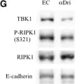 Fig.4.G showing Western Blotting in a Mus musculus (House mouse) sample from the publication: Housing conditions affect enterocyte death mode and turnover rate in mouse small intestine.