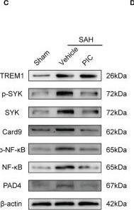 Fig.8.C showing Western Blotting from the publication: TREM1 Regulates Neuroinflammatory Injury by Modulate Proinflammatory Subtype Transition of Microglia and Formation of Neutrophil Extracellular Traps via Interaction With SYK in Experimental Subarachnoid Hemorrhage.