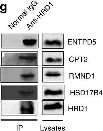 Fig.3.G showing Western Blotting from the publication: ER-associated ubiquitin ligase HRD1 programs liver metabolism by targeting multiple metabolic enzymes.