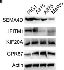 Fig.9.B showing Western Blotting in a Homo sapiens (Human) sample from the publication: Development and Validation of a Combined Glycolysis and Immune Prognostic Model for Melanoma.