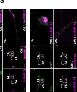 Fig.4.G showing Immunocytochemistry-immunofluorescence from the publication: hnRNP Q and hnRNP A1 Regulate the Translation of Cofilin in Response to Transient Oxygen-Glucose Deprivation in Hippocampal Neurons.
