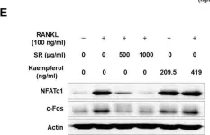Fig.12.E showing Western Blotting from the publication: Effects of Sparganii Rhizoma on Osteoclast Formation and Osteoblast Differentiation and on an OVX-Induced Bone Loss Model.