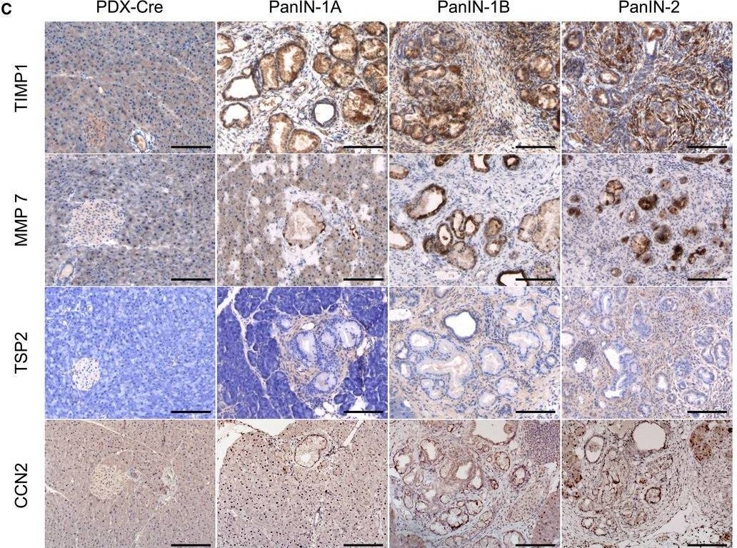 Fig.3.C showing Immunohistochemistry in a Mus musculus (House mouse) sample from the publication: Soluble stroma-related biomarkers of pancreatic cancer.