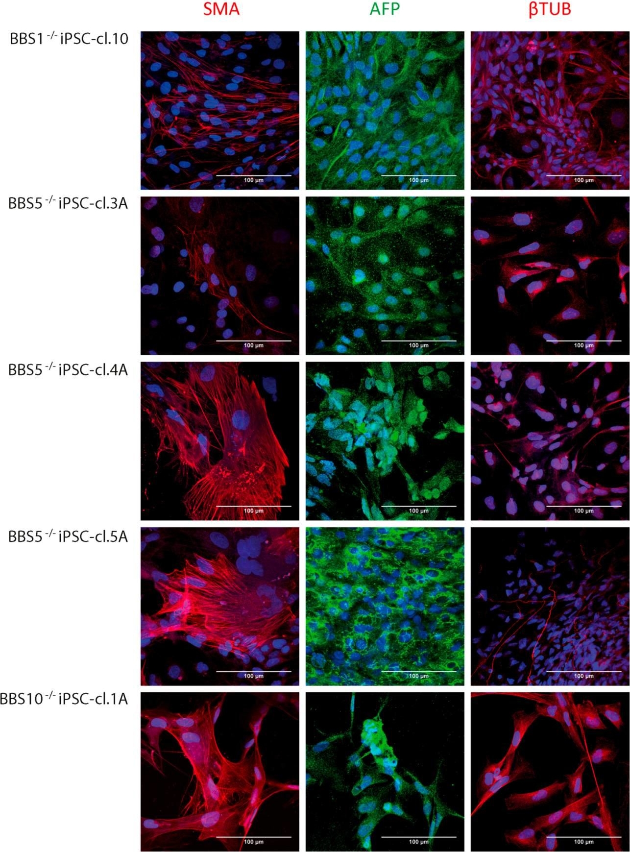 Fig.3.A showing Immunocytochemistry in a Homo sapiens (Human) sample from the publication: BBS Proteins Affect Ciliogenesis and Are Essential for Hedgehog Signaling, but Not for Formation of iPSC-Derived RPE-65 Expressing RPE-Like Cells.