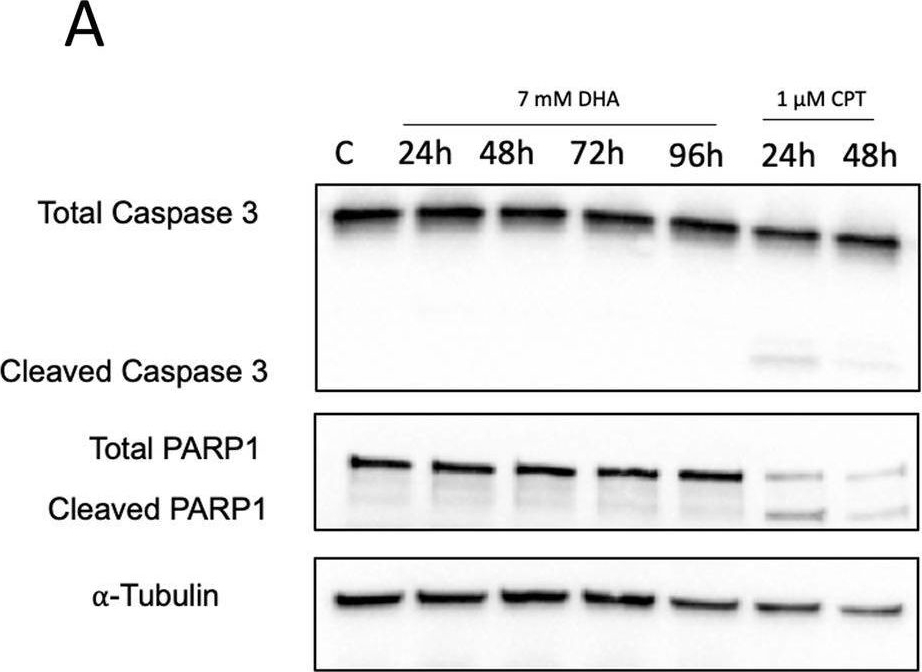Fig.4.A showing Western Blotting in a Homo sapiens (Human) sample from the publication: Dihydroxyacetone suppresses mTOR nutrient signaling and induces mitochondrial stress in liver cells.