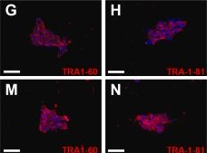 Fig.1.C showing Immunocytochemistry-immunofluorescence from the publication: Otic organoids: A model to study spiral ganglion neuron characteristics in Tmprss3-deficiency.