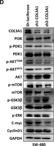 Fig.5.D showing Western Blotting from the publication: Epithelial but not stromal expression of collagen alpha-1(III) is a diagnostic and prognostic indicator of colorectal carcinoma.