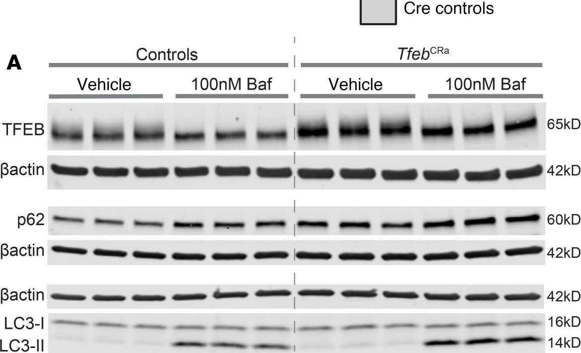 Fig.2.A showing Western Blotting from the publication: Elevation of master autophagy regulator Tfeb in osteoblast lineage cells increases bone mass and strength.