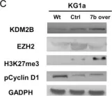 Fig.4.C showing Western Blotting in a Homo sapiens (Human) sample from the publication: The KDM2B- let-7b -EZH2 axis in myelodysplastic syndromes as a target for combined epigenetic therapy.