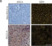 Fig.2.B showing Immunohistochemistry from the publication: Unveiling the powerhouse: ASCL1-driven small cell lung cancer is characterized by higher numbers of mitochondria and enhanced oxidative phosphorylation.