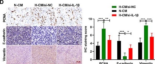 Fig.4.D showing Immunohistochemistry from the publication: Hypoxia-induced activation of HIF-1alpha/IL-1beta axis in microglia promotes glioma progression via NF-κB-mediated upregulation of heparanase expression.