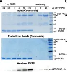 Fig.5.A showing Western Blotting in a Homo sapiens (Human) sample from the publication: Tripartite interactions of PKA catalytic subunit and C-terminal domains of cardiac Ca2+ channel may modulate its β-adrenergic regulation.
