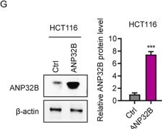 Fig.2.G showing Western Blotting from the publication: ANP32B promotes colorectal cancer cell progression and reduces cell sensitivity to PRAP1 inhibitor through up-regulating HPF1.