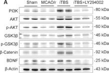 Fig.3.A showing Western Blotting from the publication: Intermittent theta-burst stimulation promotes neurovascular unit remodeling after ischemic stroke in a mouse model.