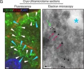 Fig.5.G showing Immunohistochemistry-immunofluorescence in a Mus musculus (House mouse) sample from the publication: Identification of CD133+ intercellsomes in intercellular communication to offset intracellular signal deficit.