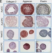 Fig.6.E showing Immunohistochemistry in a Homo sapiens (Human) sample from the publication: Small spheroids for head and neck cartilage tissue engineering.