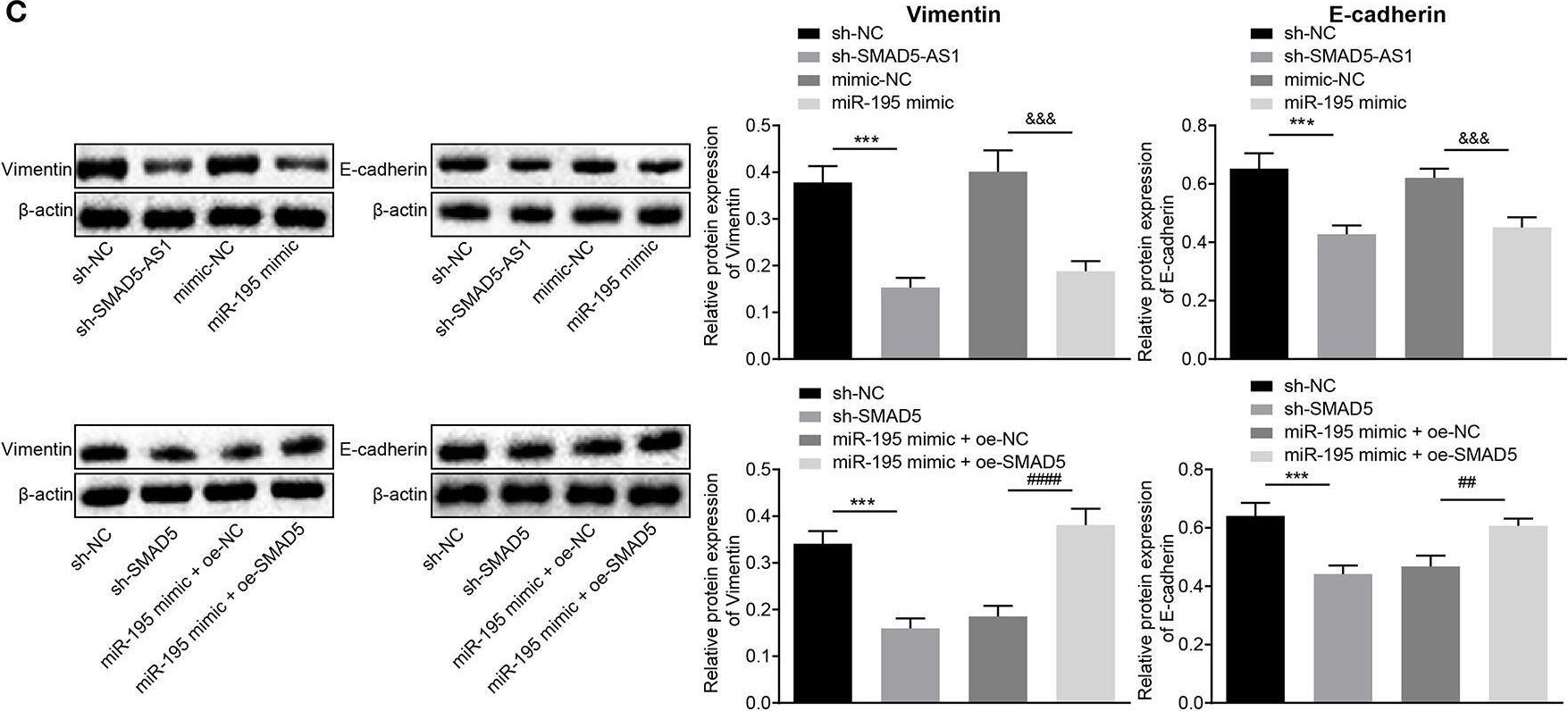 Fig.5.C showing Western Blotting in a Homo sapiens (Human) sample from the publication: Silencing of Long Non-coding RNA SMAD5-AS1 Reverses Epithelial Mesenchymal Transition in Nasopharyngeal Carcinoma via microRNA-195-Dependent Inhibition of SMAD5.
