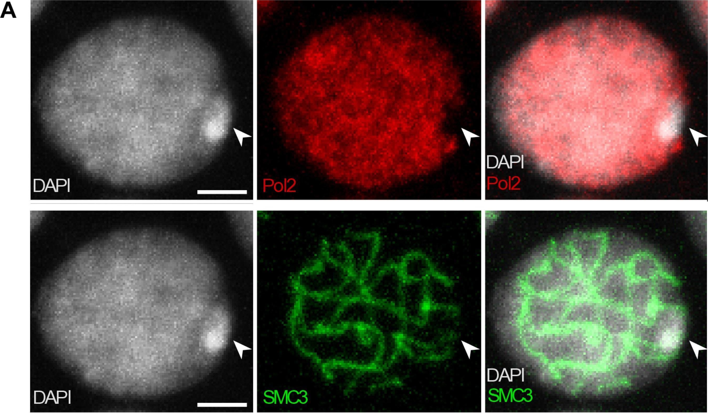 Fig.4.A showing Immunocytochemistry-immunofluorescence in a Drosophila melanogaster (Fruit fly) sample from the publication: Dynamics of X chromosome hyper-expression and inactivation in male tissues during stick insect development.