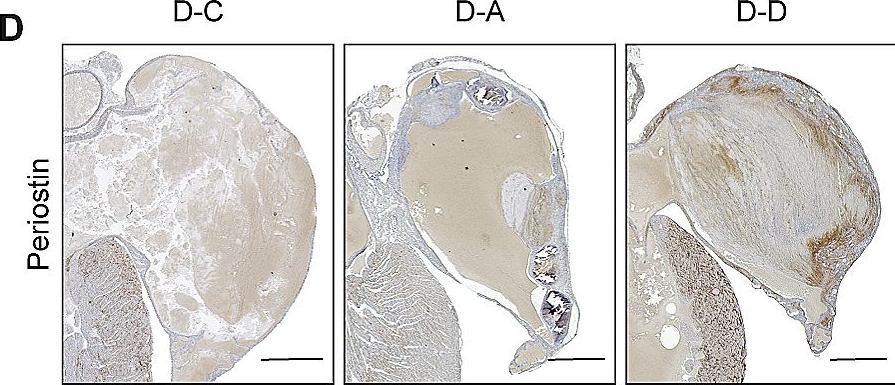 Fig.4.D showing Immunohistochemistry in a Mus musculus (House mouse) sample from the publication: Diversifying the anthracycline class of anti-cancer drugs identifies aclarubicin for superior survival of acute myeloid leukemia patients.