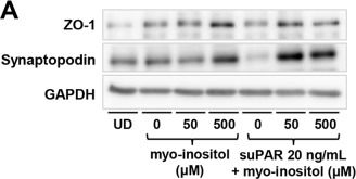 Urinary myo-inositol is associated with the clinical outcome in focal segmental glomerulosclerosis.