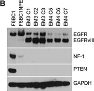 Fig.6.B showing Western Blotting from the publication: Elevated FOXG1 in glioblastoma stem cells cooperates with Wnt/β-catenin to induce exit from quiescence.