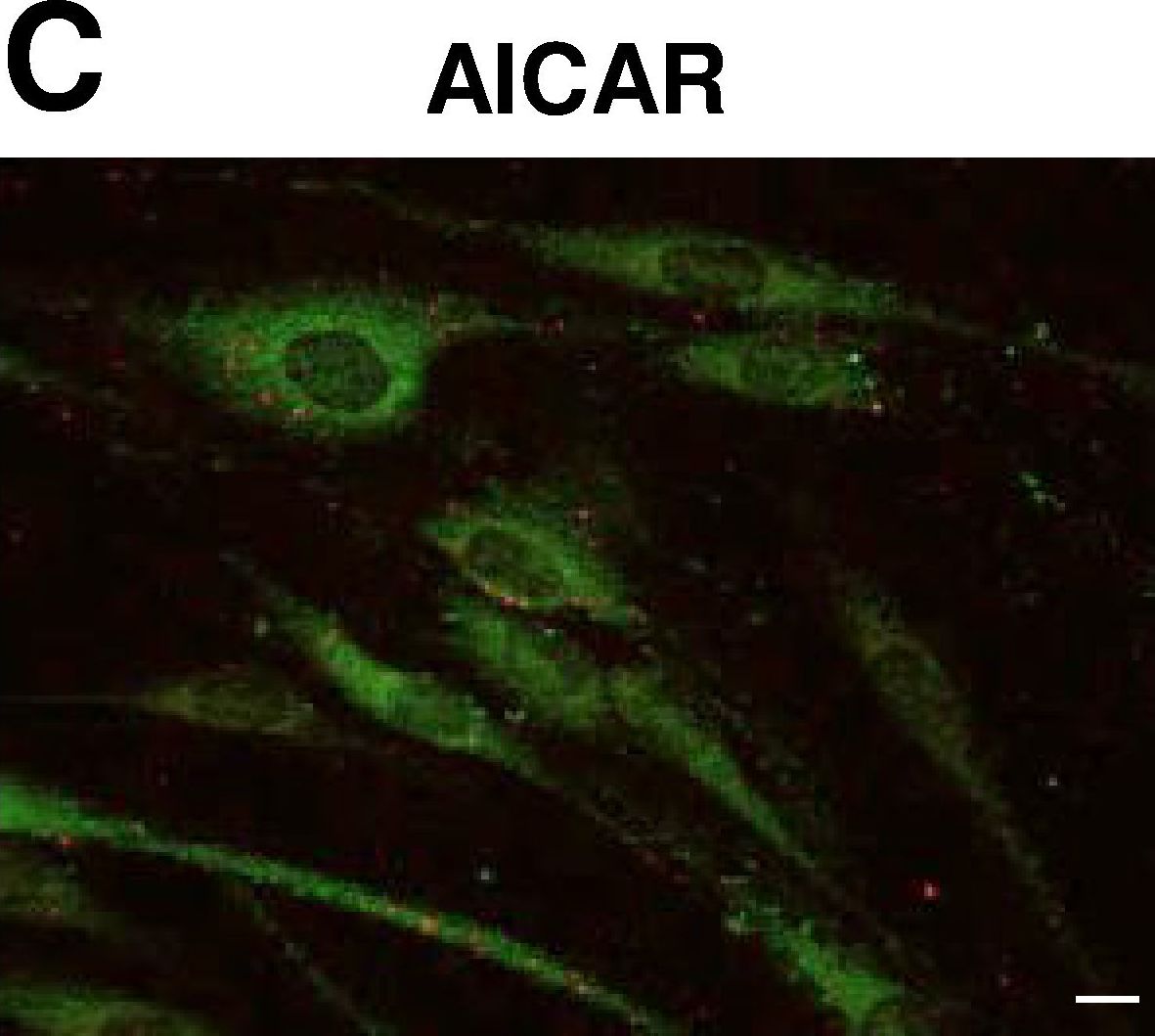 Cellular localization and associations of the major lipolytic proteins in human skeletal muscle at rest and during exercise.