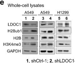 Fig.1.E showing Western Blotting from the publication: LDOC1 connects histone H2B monoubiquitination to tumor cell plasticity in non-small cell lung cancer.