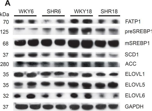 Fig.3.A showing Western Blotting in a Rattus norvegicus (Rat) sample from the publication: Alterations of Lipid Metabolism in the Heart in Spontaneously Hypertensive Rats Precedes Left Ventricular Hypertrophy and Cardiac Dysfunction.