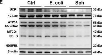 Fig.6.E showing Western Blotting from the publication: Adipose Tissue-Resident Sphingomonas Paucimobilis Suppresses Adaptive Thermogenesis by Reducing 15-HETE Production and Inhibiting AMPK Pathway.
