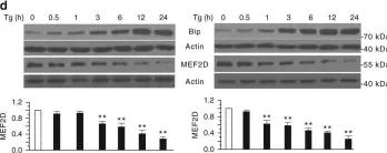 Fig.1.D showing Western Blotting in a Mus musculus (House mouse) sample from the publication: Phosphorylation of LAMP2A by p38 MAPK couples ER stress to chaperone-mediated autophagy.
