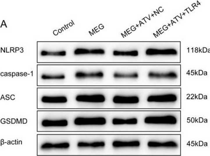 Fig.5.A showing Western Blotting in a Rattus norvegicus (Rat) sample from the publication: Atorvastatin reduces contrast media-induced pyroptosis of renal tubular epithelial cells by inhibiting the TLR4/MyD88/NF-κB signaling pathway.